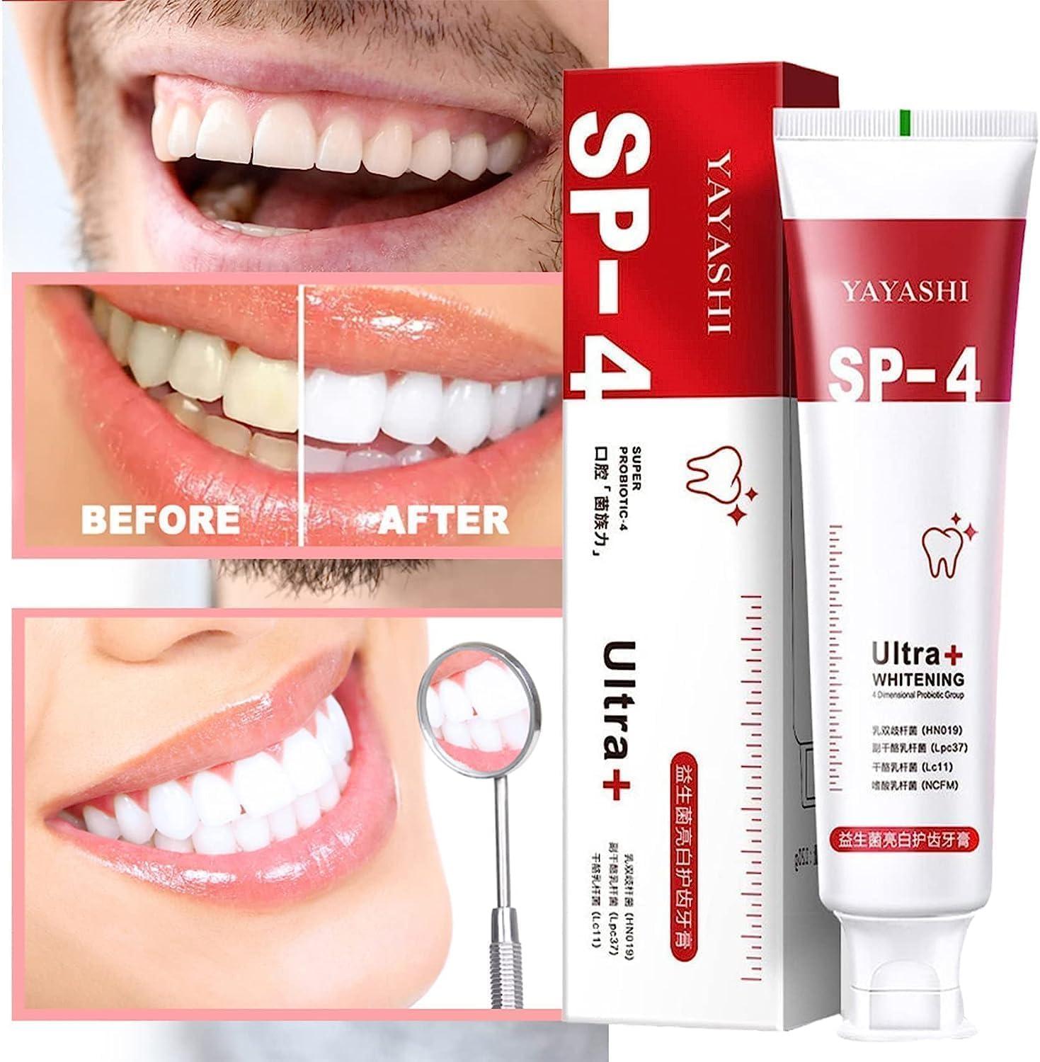 SP 4 Whitening Tooth Pate
